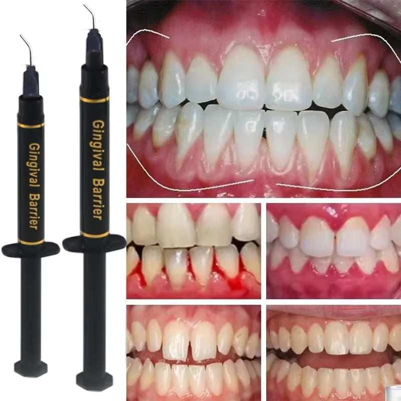 Dental Syringe Gum Protector Gel Clinic Gingival Barrier Professional Teeth Whitening Care Gingival Barrier